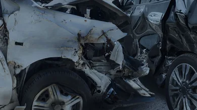 Car accident injury