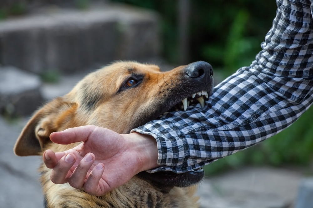 Person suffering a dog bite injury that may result in a Florida dog bite claim