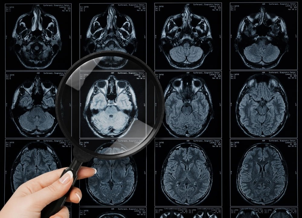 Revisión de imágenes médicas como parte de una reclamación por negligencia médica en Florida